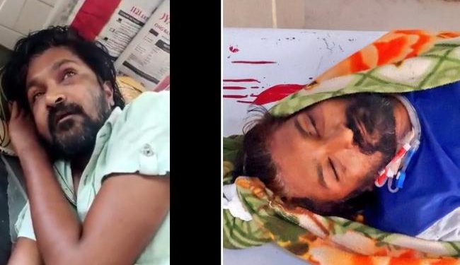 Medak: Man Accused of Theft Succumbs to Injuries Due to Alleged Custodial Torture